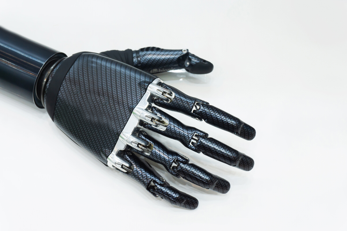 Bionic Carbon Fiber Arm